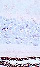抗マウスチオレドキシン-１抗体